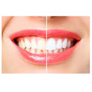 Colgate Toothpaste Anti-Tartar Whitening 100ml - Exclusive Deals Ltd - Exclusive Deals